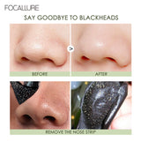 Black Head Remover Pore Strips - 7 Pieces