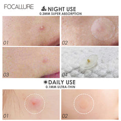 Acne Pimple Daily Patch